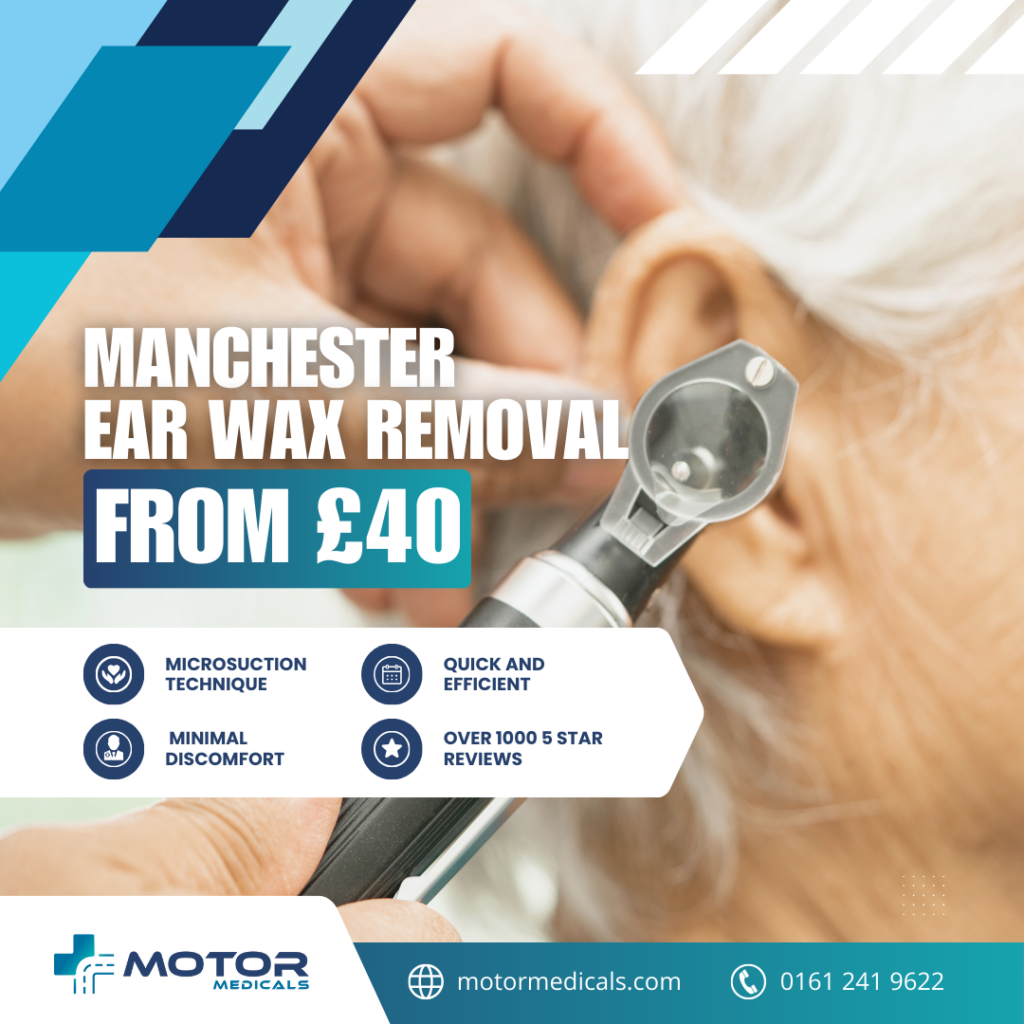 Expert microsuction ear wax removal at MotorMedicals Ltd Radcliffe Clinic. Prices: £40 for one ear, £45 for both. Call 0161 241 9622 for appointments.