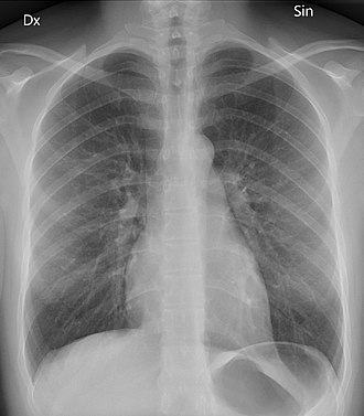 Why smoking may delay your driver medical approval