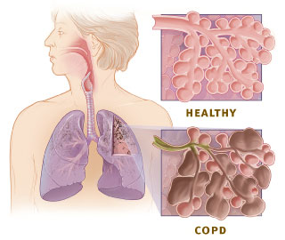 Motor Medicals blog – Smoking and its effect on driver medicals £47