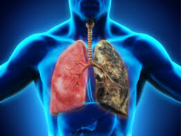 How smoking affects your driver medical – Motor Medicals from £47